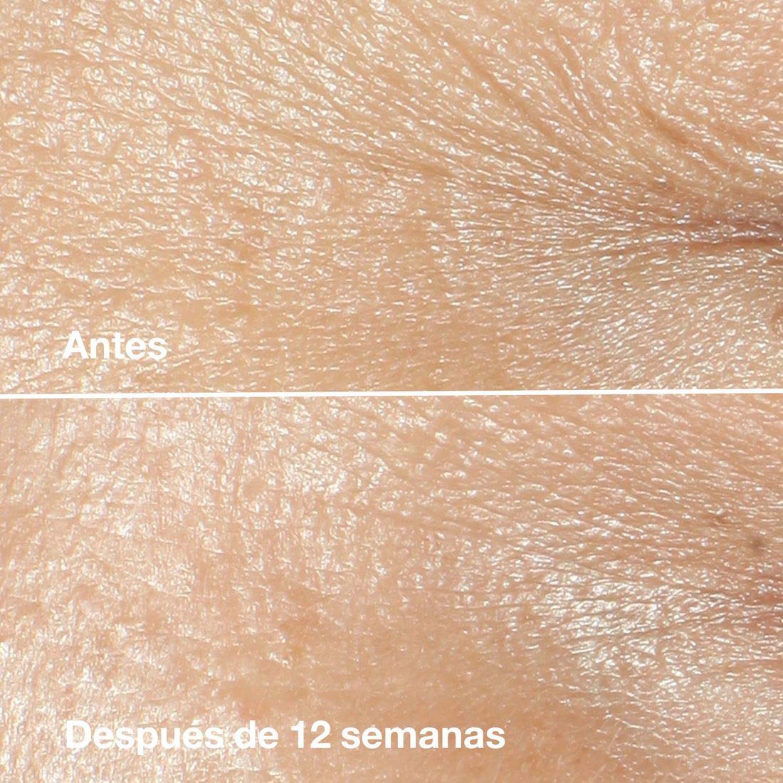 Smart Clinical Repair™ Wrinkle Correcting Cream