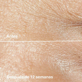 Smart Clinical Repair™ Wrinkle Correcting Cream